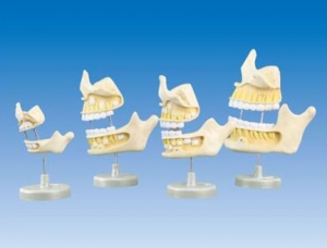 ZM1054牙齒發(fā)育模型（新生兒、5歲、9歲、20歲階段）