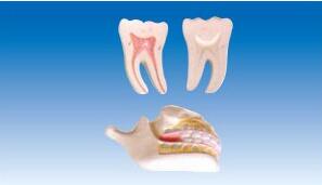 ZM1050  牙列與磨齒模型