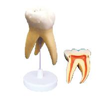 ZM1049-1 磨牙分解模型